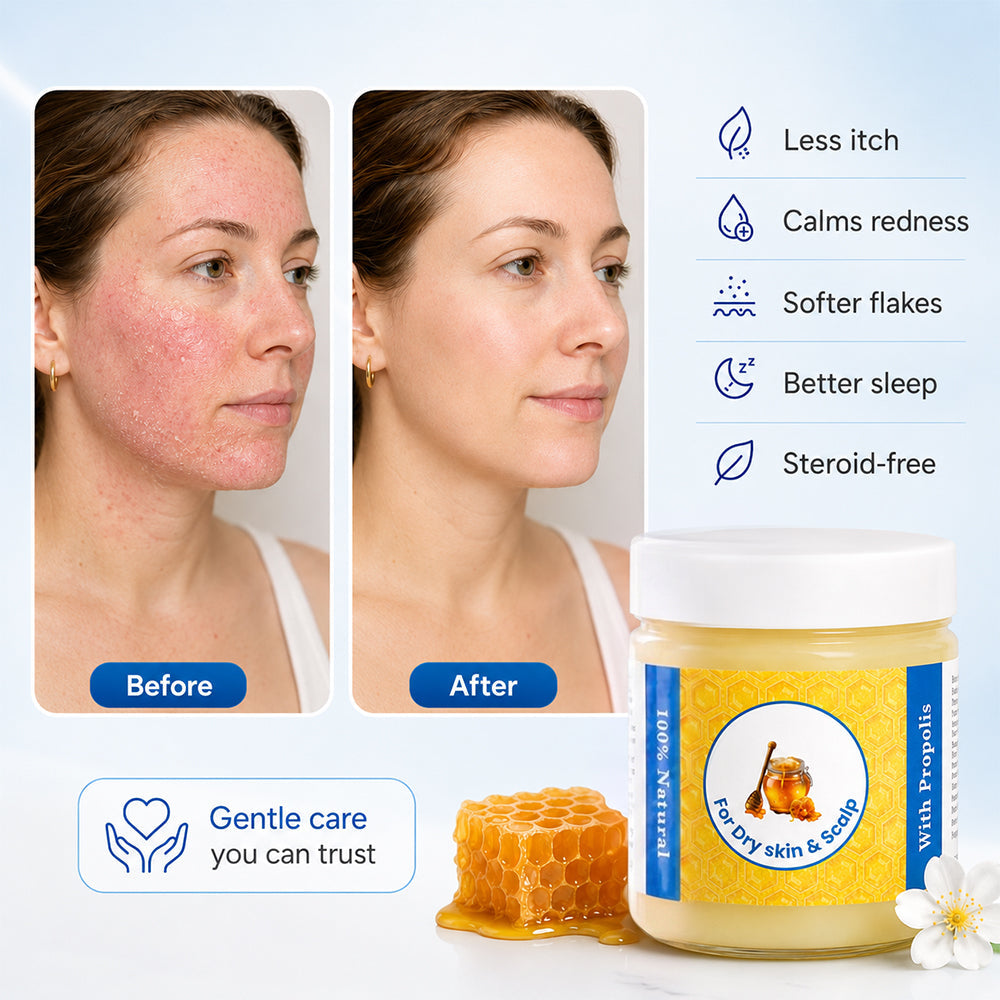 lilflorea™ Repair Balm For Eczema & Psoriasis