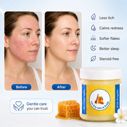 lilflorea™ Repair Balm For Eczema & Psoriasis