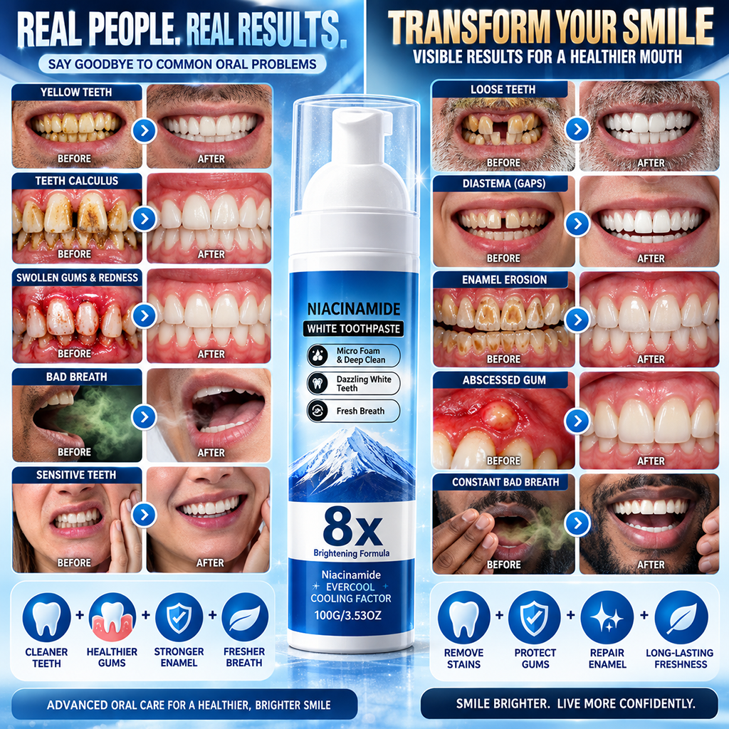 🦷High-Strength Hydroxyapatite + Niacinamide Toothpaste🧪 Fight Plaque, Tartar, Yellow Teeth, Bad Breath & Gum Problems With Every Brush-8JX3