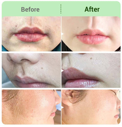 🔥 LAST DAY BUY 1 GET 1 FREE💛Hair Removal Cream Kit for Women