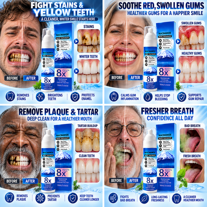 🦷High-Strength Hydroxyapatite + Niacinamide Toothpaste🧪 Fight Plaque, Tartar, Yellow Teeth, Bad Breath & Gum Problems With Every Brush-8JX3