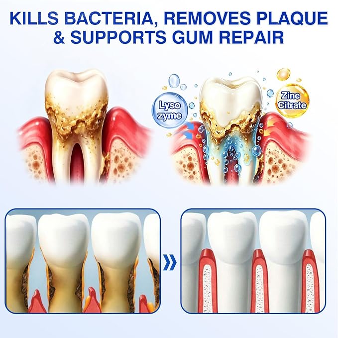 LILFLOREA® 🦷GumRevive periodontal repair gel🌈