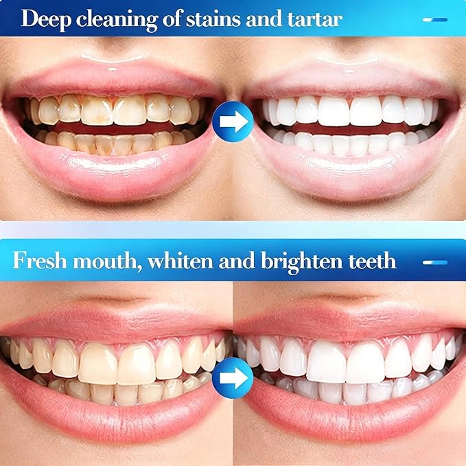 LILFLOREA® 🦷GumRevive periodontal repair gel🌈
