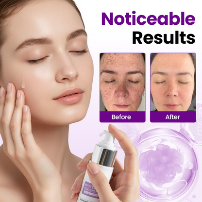 Filflorea® SpotErase Probiotic Shield Serum