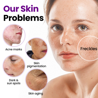 Filflorea® SpotErase Probiotic Shield Serum