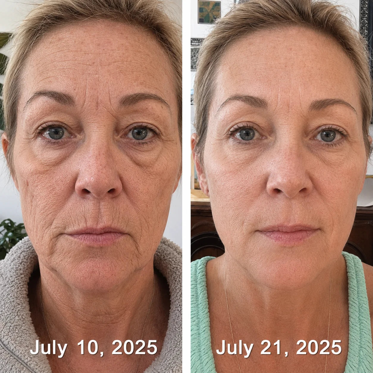 Lilflorea® PDRN Wrinkle Smoothing & Firming Cream