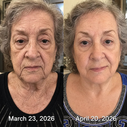 Lilflorea® PDRN Wrinkle Smoothing & Firming Cream