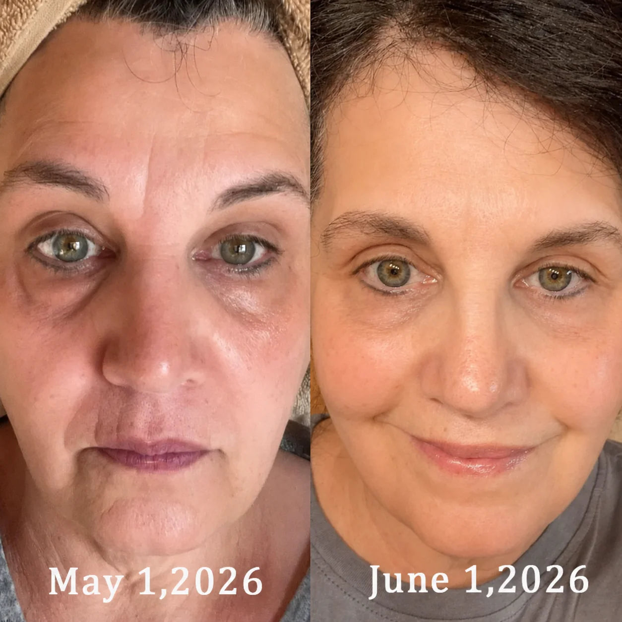 Lilflorea® PDRN Wrinkle Smoothing & Firming Cream