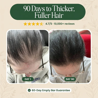 Korean Scalp Revival Bar