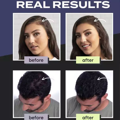 Hair Building Fibers – Instant Thickness & Waterproof Design, No More Bald Spots