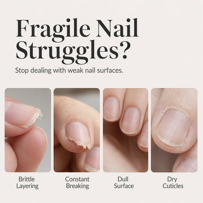 🔥Hot Sale - 50% OFF🔥Garlic Nail Polish for Strengthening Brittle, Damaged Nails