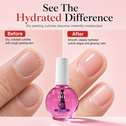 🥳 2026 Hot Sale - 50% OFF🥳💞 Over 10,000 sold! Cuticle Care Oil—Deeply moisturizing, available in 6 scents, and comes with a precision brush. Get healthy, beautiful nails—hurry and grab yours now! ✅
